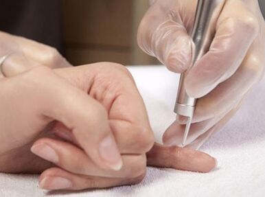 Carrying out laser therapy